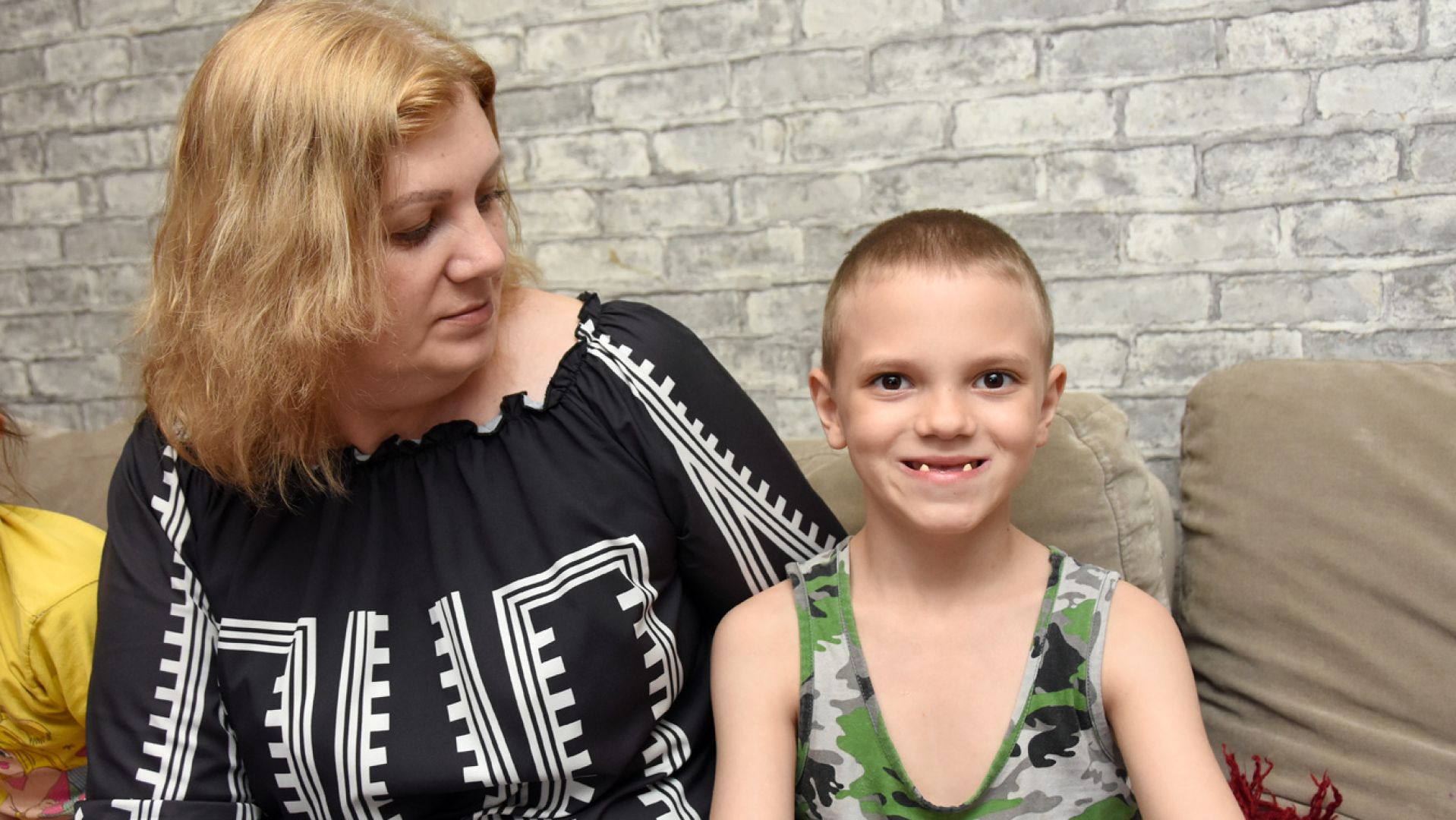 У 10-летнего мальчика из‑за редкого заболевания выпали почти все зубы