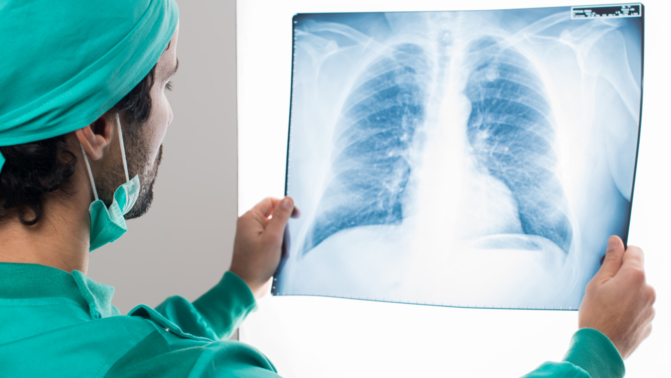 «За 10 дней пневмония съела 99% лёгких»